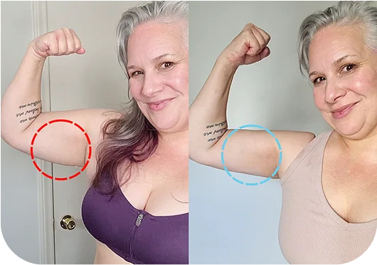 MyoGlow Antes e Depois - Atena